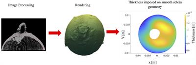 A Subdomain Method for Mapping the Heterogeneous Mechanical Properties of the Human Posterior Sclera